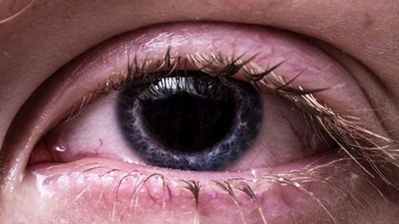 Kapalı alanlardaki düşük nem göz kuruluğunu tetikliyor