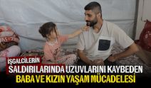 İşgalcilerin saldırısında uzuvlarını kaybeden Filistinli baba ve kızı yaşam mücadelesi veriyor