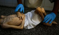 Katil İsrail'in saldırıları altındaki Gazze'de bir çocuk daha "açlıktan" öldü