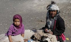 Yemen'de çocukların yüzde 50'sinde kronik yetersiz beslenme görülüyor
