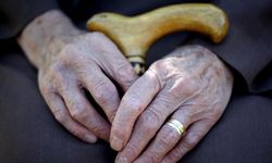 Dünyada 55 milyondan fazla kişi Alzheimer hastalığıyla mücadele ediyor