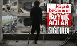 Küçük Bedenine Büyük Acılar Sığdırdı