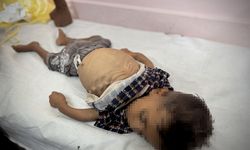 İşgalcilerin kıtlığı dayattığı Gazze'de son 24 saatte 5 kişi daha açlıktan şehit oldu