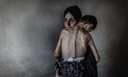 İşgalcilerin kıtlığı dayattığı Gazze'de son 24 saatte 5 kişi daha açlıktan şehit oldu