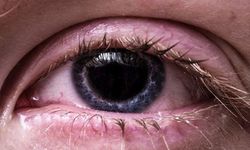 Kapalı alanlardaki düşük nem göz kuruluğunu tetikliyor