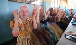 Kara kıtanın "albino" çocuklarının yüzünü TDV güldürdü