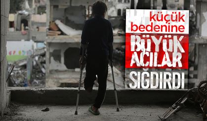 Küçük Bedenine Büyük Acılar Sığdırdı