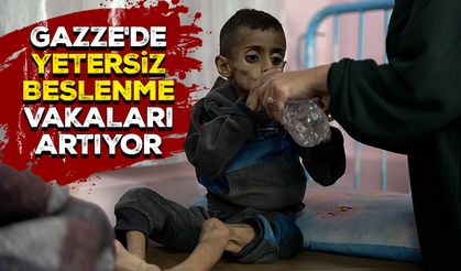 Gazze'de çocukların yetersiz beslenme vakaları artıyor
