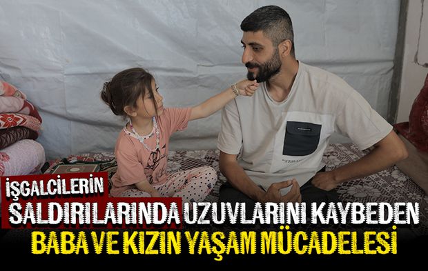 İşgalcilerin saldırısında uzuvlarını kaybeden Filistinli baba ve kızı yaşam mücadelesi veriyor