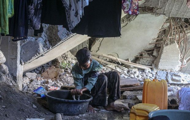 Yemen'de siviller yaşam mücadelesi veriyor