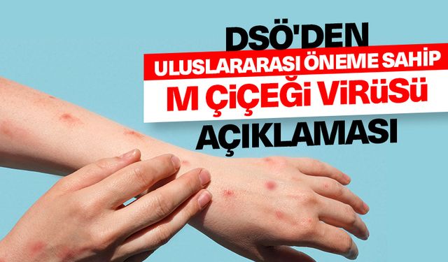 DSÖ, M çiçeği virüsünün "uluslararası öneme sahip bir halk sağlığı acil durumu oluşturduğunu" açıkladı