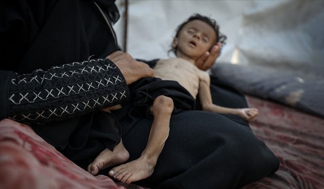 İşgalcilerin kıtlığı dayattığı Gazze'de son 24 saatte 11 kişi daha açlıktan şehit oldu