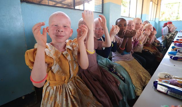 Kara kıtanın "albino" çocuklarının yüzünü TDV güldürdü