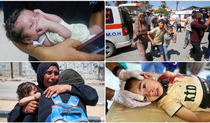 Gazze'deki yabancı doktorlar, şarapnel etkili bombaların çocuklara etkisini anlattı