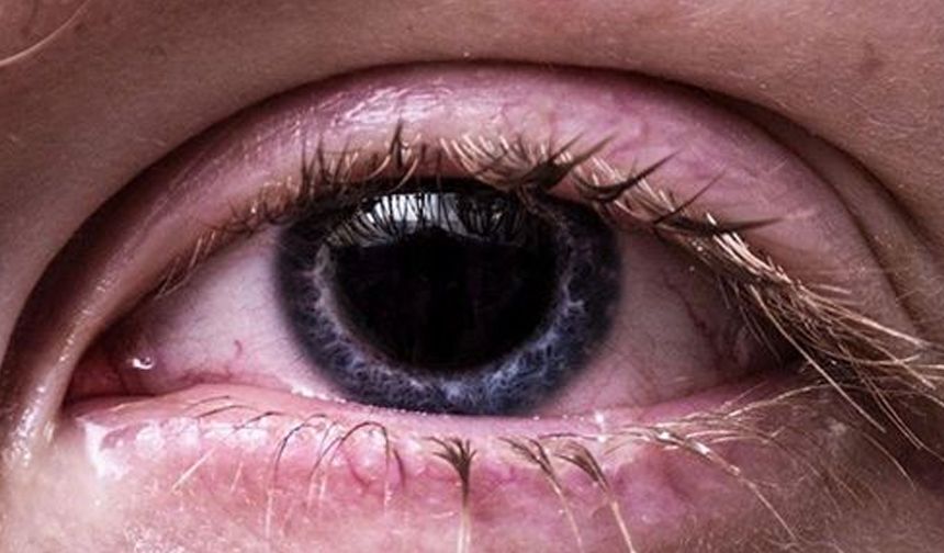 Kapalı alanlardaki düşük nem göz kuruluğunu tetikliyor