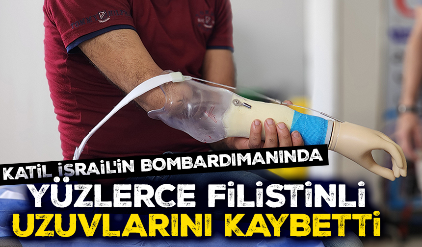 Katil İsrail'in bombardımanında yüzlerce Filistinli uzuvlarını kaybetti