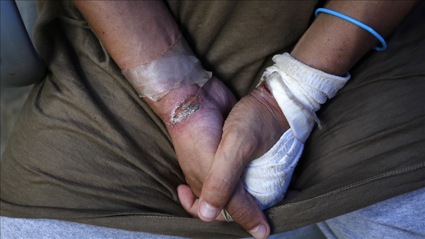 Filistin Topraklarını Gasbeden İsrailliler, Batı Şeria'da Yaraladıkları Filistinlileri Alıkoydu