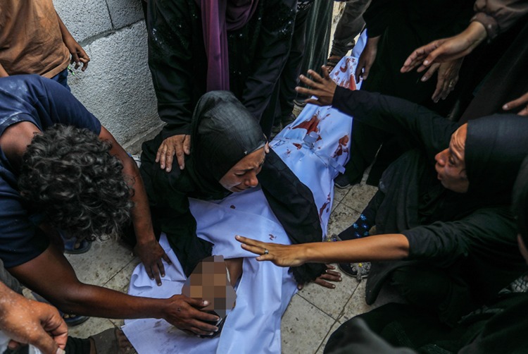 İsrail'in Kıtlığı Dayattığı Gazze'de Son 24 Saatte 5 Kişi Daha Açlıktan Hayatını Kaybetti 2