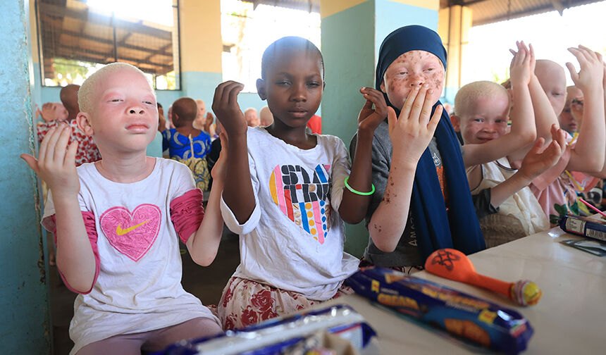 Albino Çocukları 22