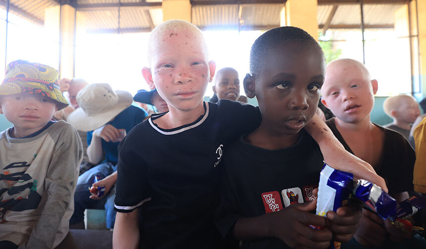 Albino Çocukları 33