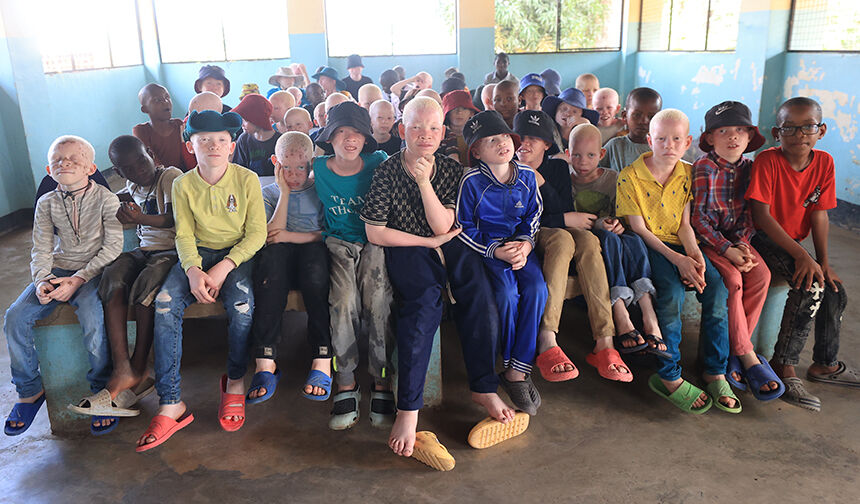 Albino Çocukları 55